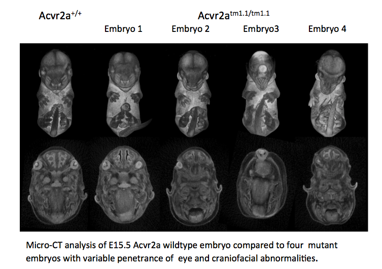 Micro-CT of E15.5 Acvr2a