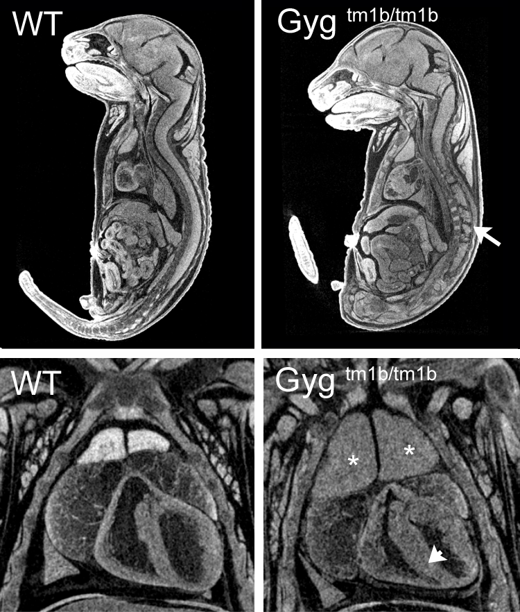 Single images from E18.5 microCT volumes showing spinal cord abnormalities (arrow), enlarged thymus (asterisk) and thickened myocardium (arrowhead) in homozygous null embryos compared to wild-type littermates.