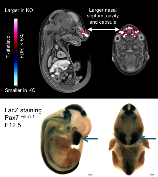 MicroCT Pax7 embryos and LacZ Staining