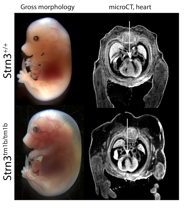 E18.5  Strn3 null embryo