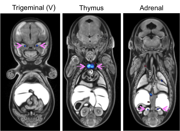 Automated MRI analysis of E15.5 Cbx4tm1.1/tm1.1