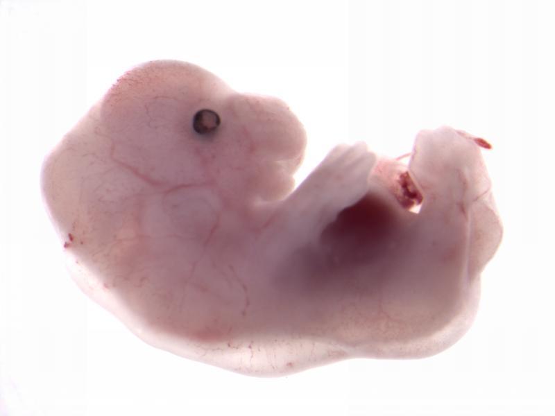 Embryo Dysmorphology Image
